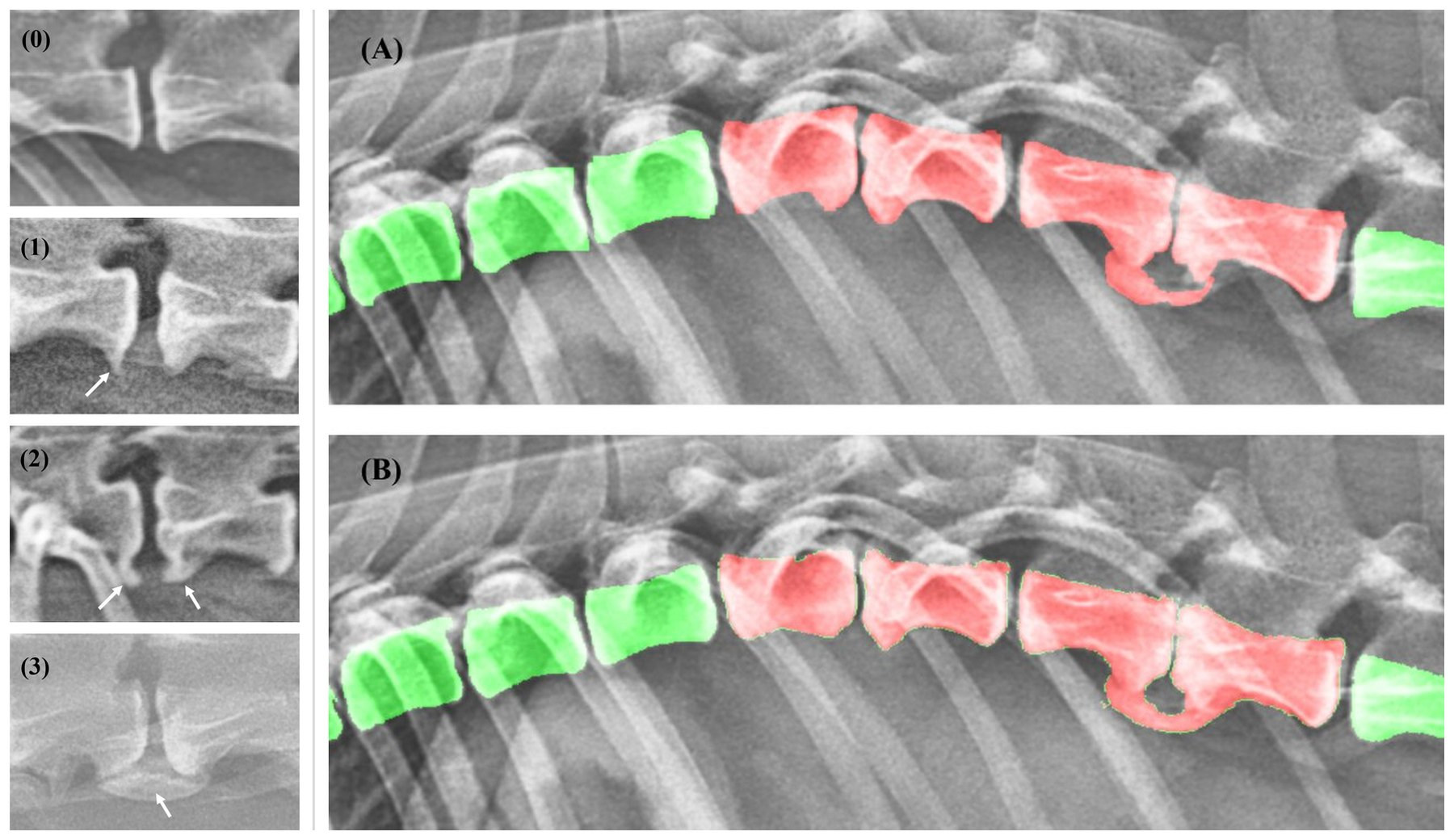 Spondylosis deformans grading (grades 0–3, arrows = bony spurs) and a modified attention U-Net → manual (A) vs. automated (B) segmentation of vertebral bodies (green) and spondylosis (red) on canine lateral X-rays · Frontiers in Veterinary Science, 2024 (JCR top 13%)