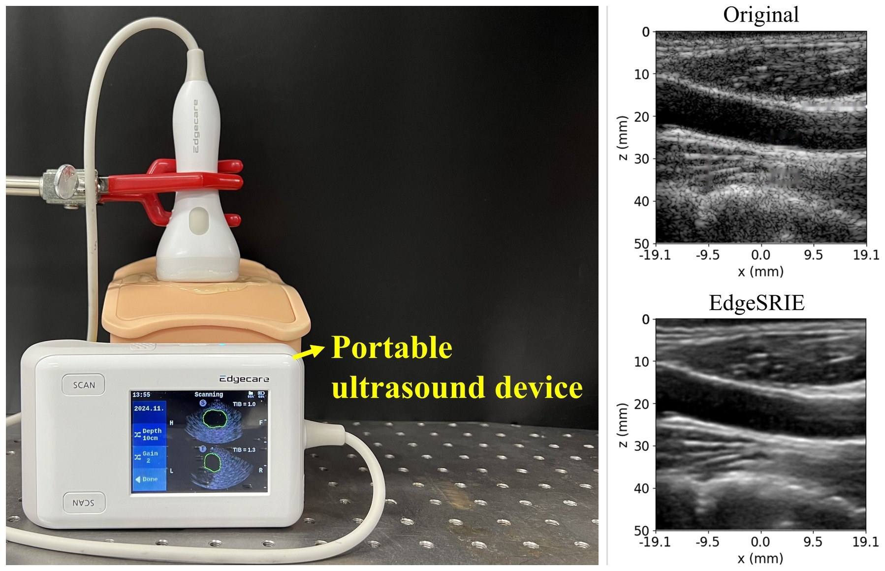 EdgeFlow UH-10 portable ultrasound scanner → Original vs. EdgeSRIE on an in vivo carotid scan (PICMUS); the deployed 8-bit model runs at 64 frames/s on the device-class low-resource SoC · Medical Physics, 2026
