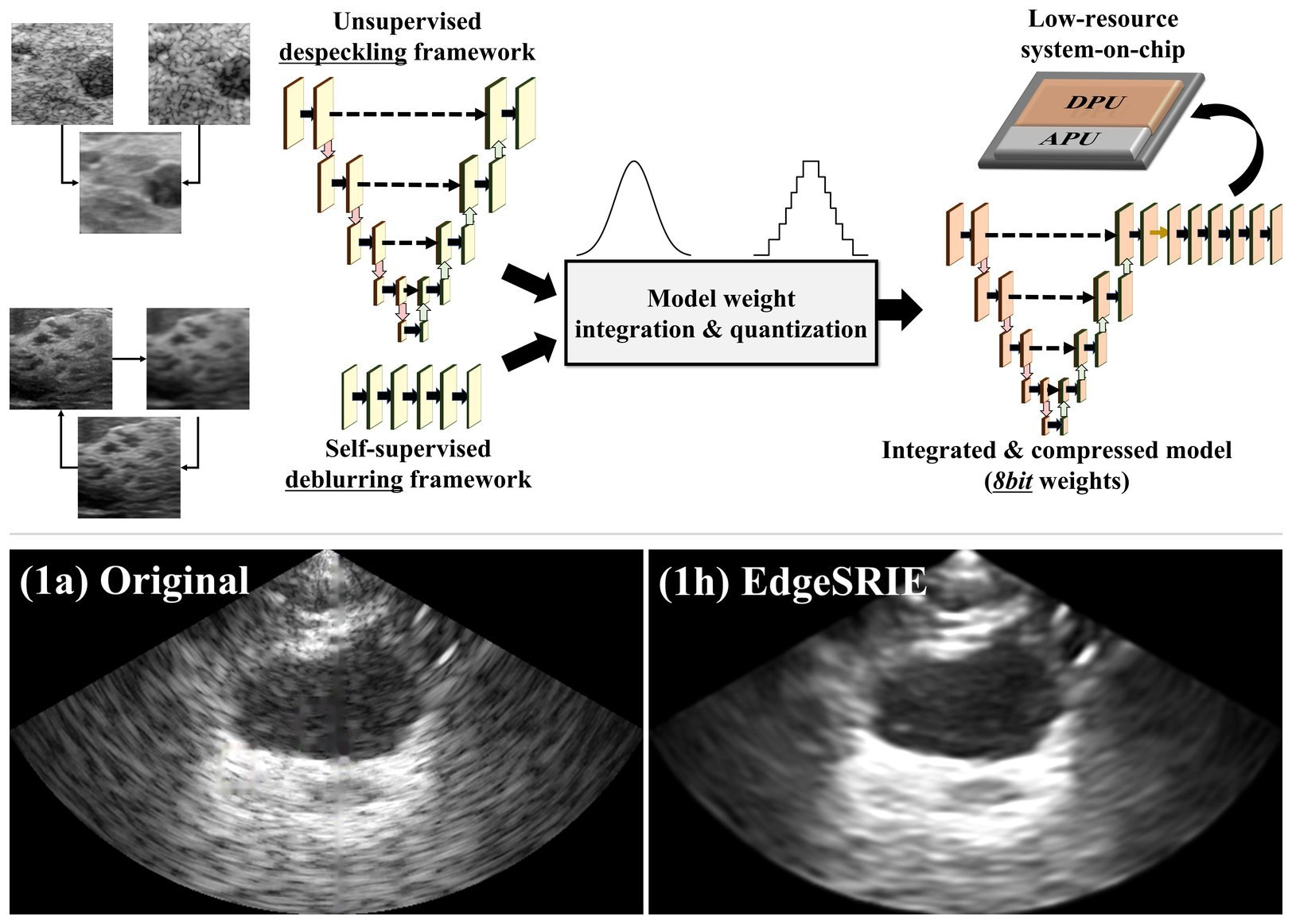 Unsupervised despeckling and self-supervised deblurring fused into one 8-bit model for a low-resource SoC → real-time speckle-reduced bladder imaging on a portable device · Medical Physics, 2026