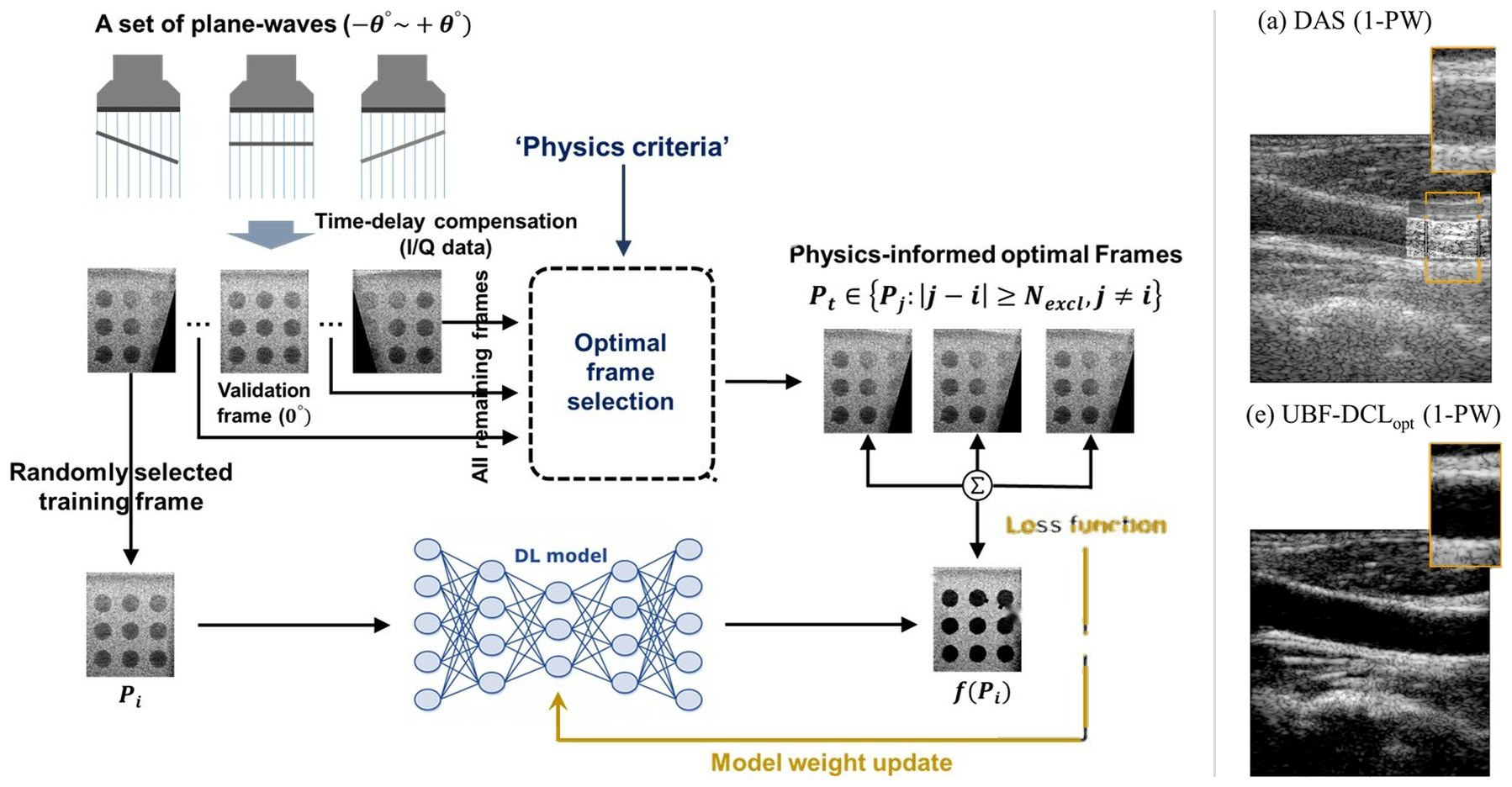 Physics-informed optimal-frame selection for an unsupervised coherence loss → clutter-suppressed single plane-wave carotid imaging (DAS vs. UBF-DCLopt) · Diagnostics, 2025 (JCR top 17%)